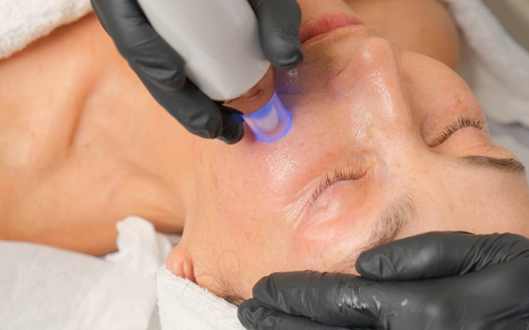 How Vivace vs Morpheus Microneedling Treatments Compare