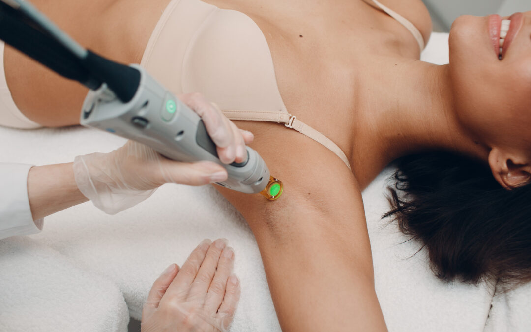 Complete Guide to Underarm Laser Hair Removal