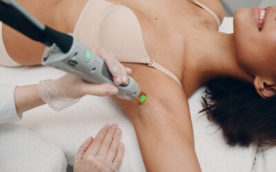 Complete Guide to Underarm Laser Hair Removal