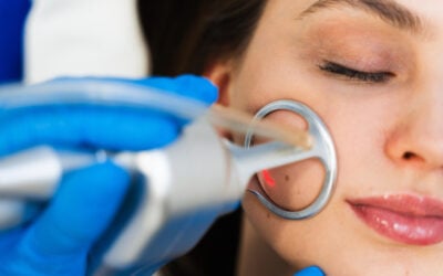 Laser Treatment for Pigmentation Cost in 2026