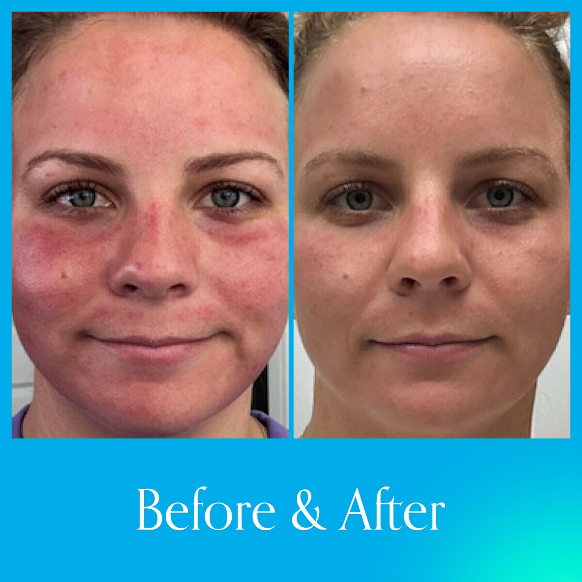Hydrinity Restorative HA+ Masque - Image 2