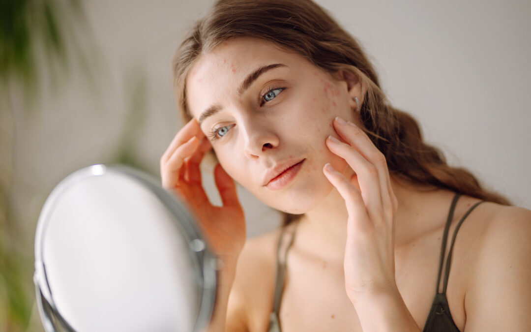 Why Do I Get Dark Spots and How to Get Rid of Them?