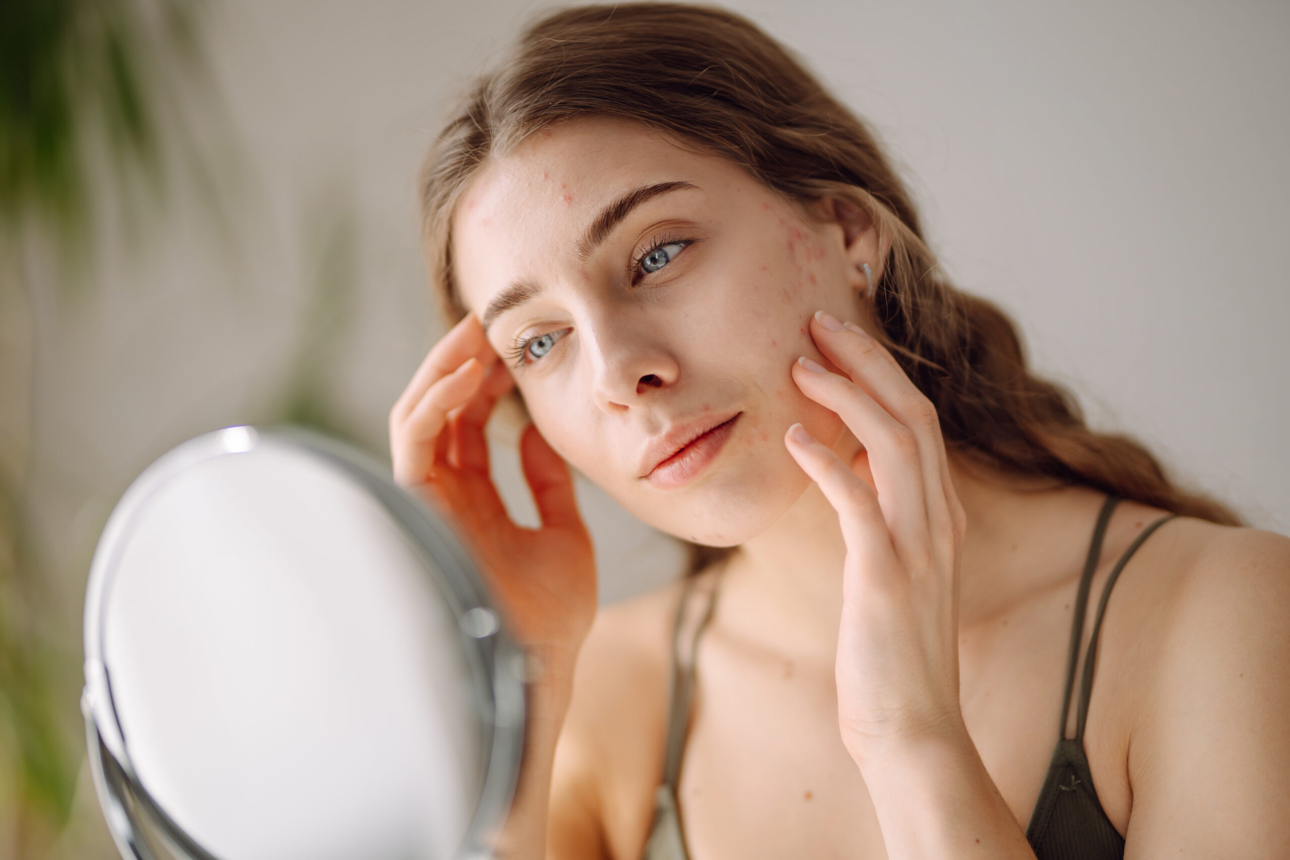 Why Do I Get Dark Spots and How to Get Rid of Them?