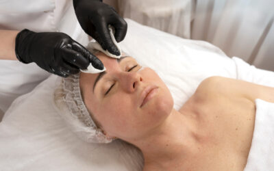 Can You Buy a Chemical Peel Online?
