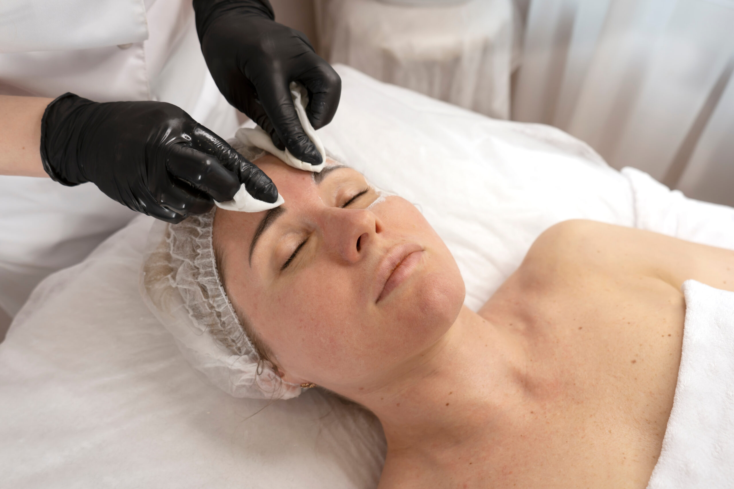 Can You Buy a Chemical Peel Online? Can You Buy a Chemical Peel Online?