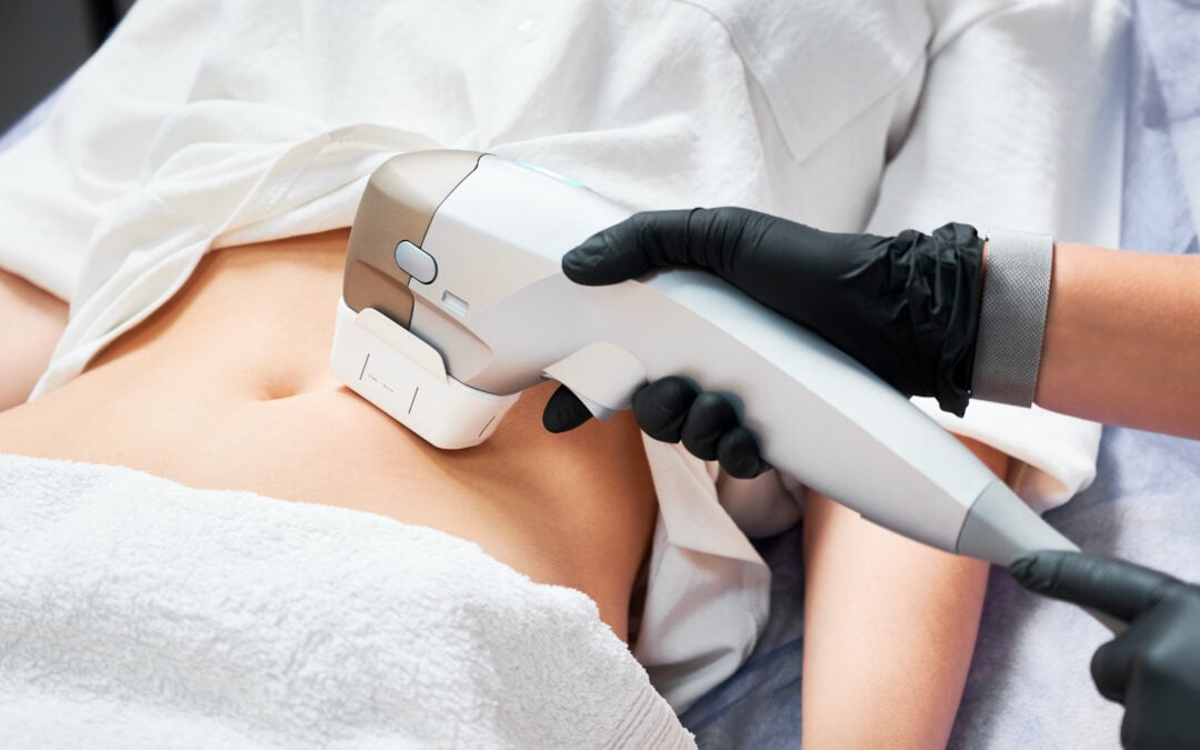 How to Tighten Loose Skin after GLP-1 Weight Loss