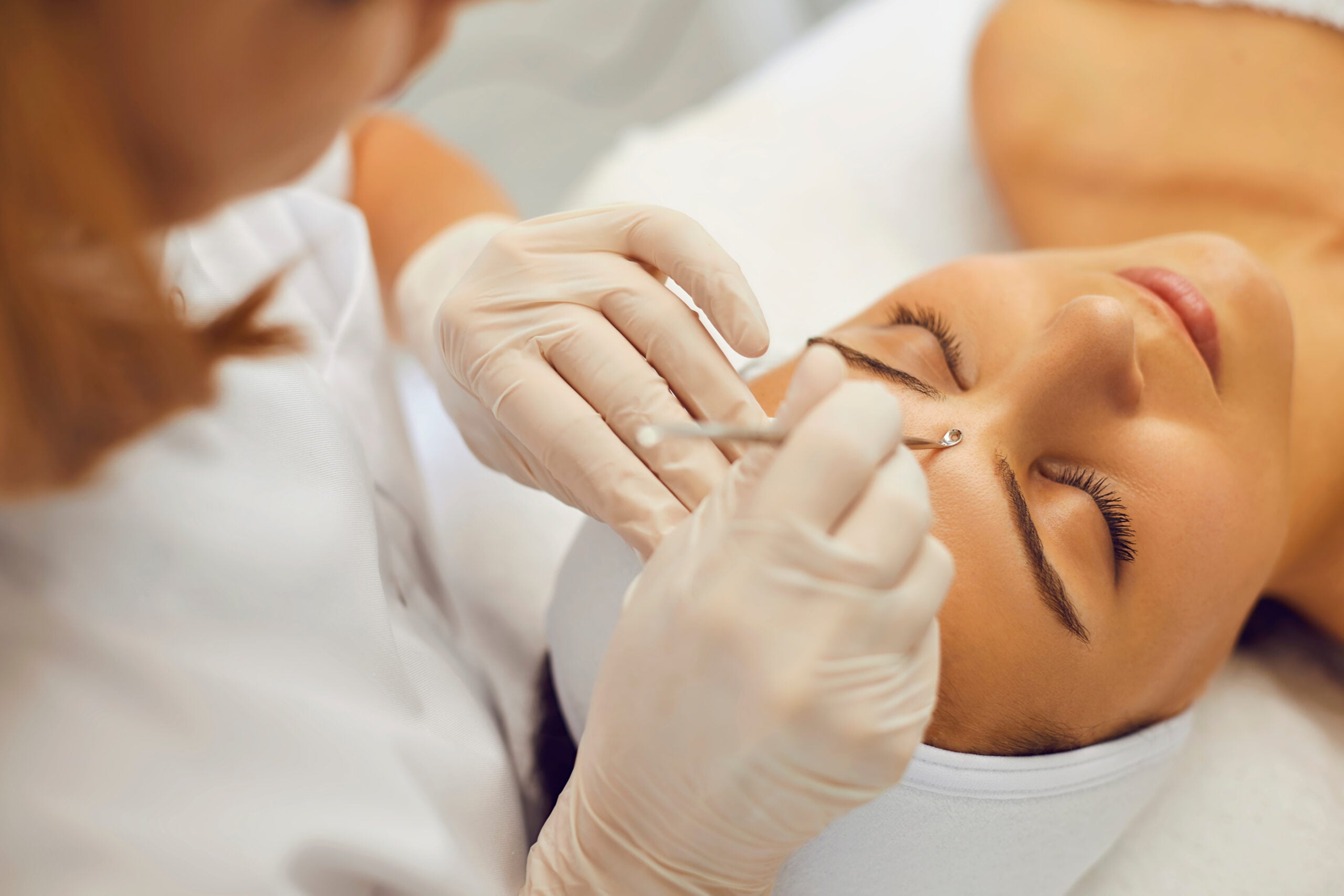 Why Those White Bumps Appear on Your Skin Why Those White Bumps Appear on Your Skin
